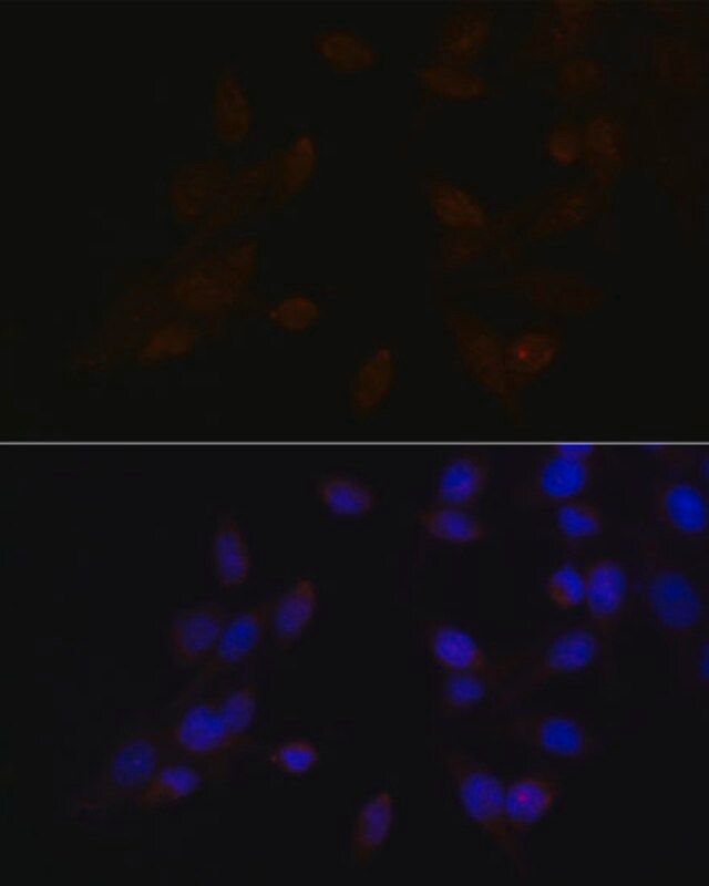 Anti-ATF4 antibody produced in rabbit