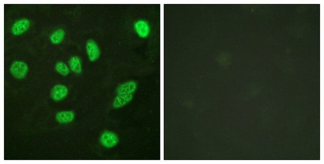 Anti-B-MYB antibody produced in rabbit