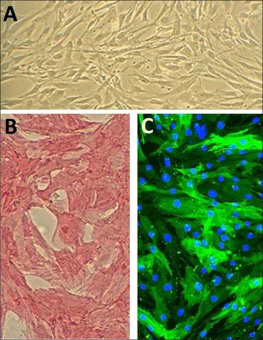 Human Aortic Smooth Muscle Cells: HAOSMC, fetal