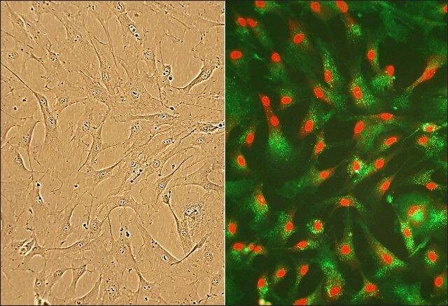 Human Cardiac Fibroblasts: HCF, fetal