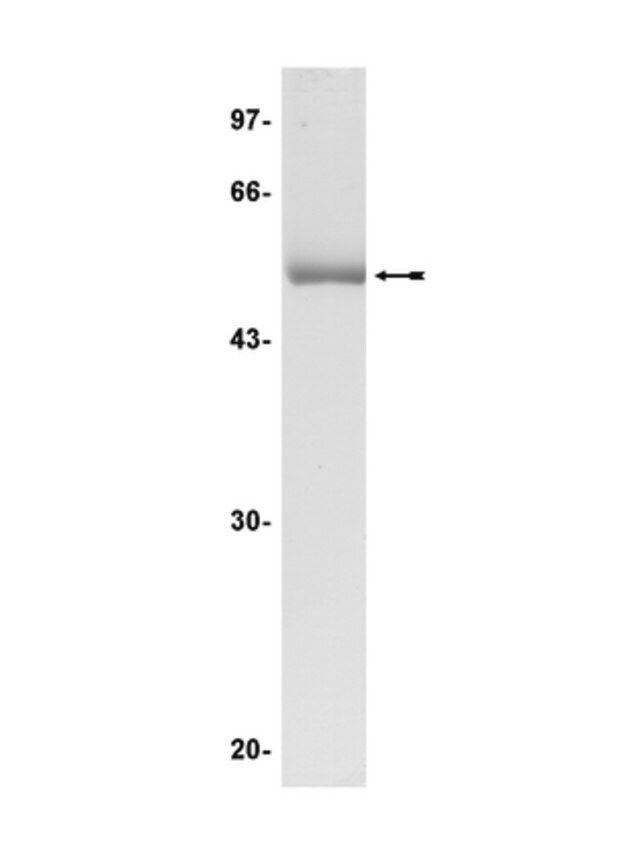 JNK22/SAPK1a Protein, inactive, 50 g