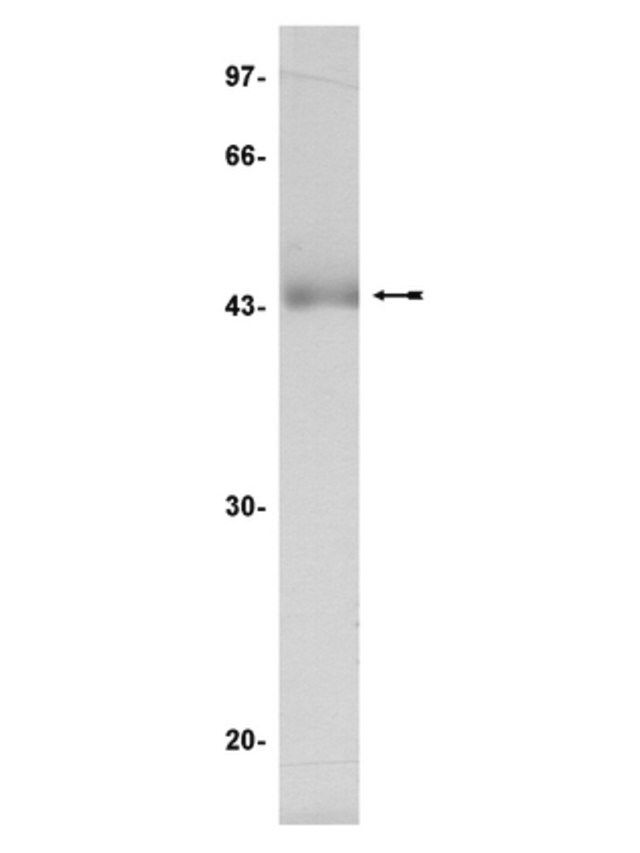 JNK11/SAPK1c Protein, inactive, 50 g