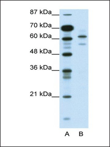 Anti-ZSCAN2 (AB1) antibody produced in rabbit