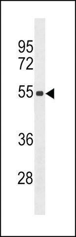 ANTI-ZSCAN5C (CENTER) antibody produced in rabbit