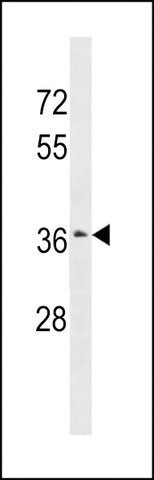 ANTI-ZSCAN23 (CENTER) antibody produced in rabbit