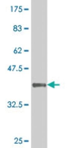 ANTI-ZSCAN21 antibody produced in mouse