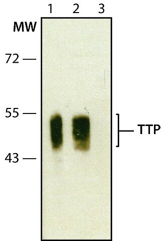 Anti-TTP (C-terminal) antibody produced in rabbit