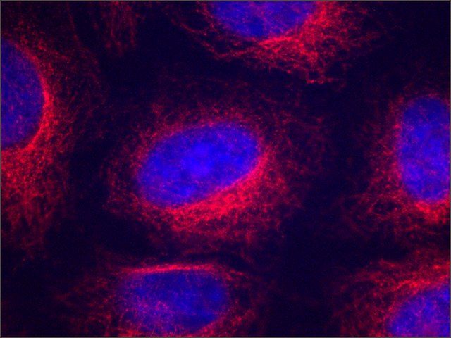 Anti--Tubulin antibody, Mouse monoclonal