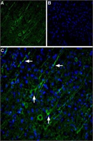 Anti-TRPC5 antibody produced in rabbit