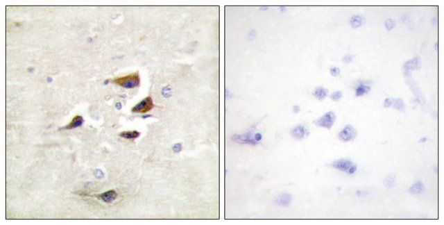 Anti-CAMK2 antibody produced in rabbit