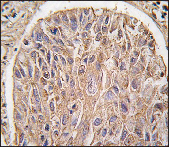 Anti-IKK antibody produced in rabbit