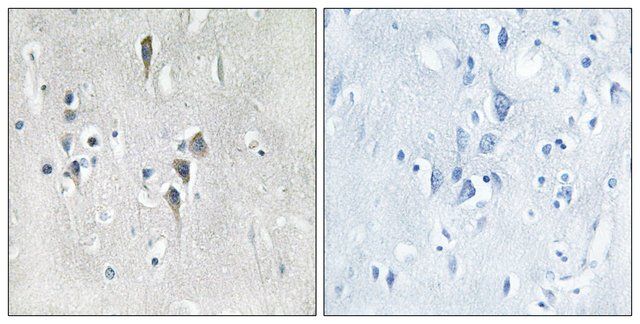 Anti-CAMK2 antibody produced in rabbit