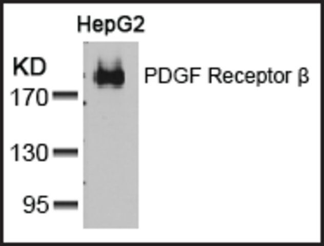 Anti-PDGFRB (Ab-751) antibody produced in rabbit