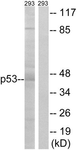 Anti-p53 antibody produced in rabbit