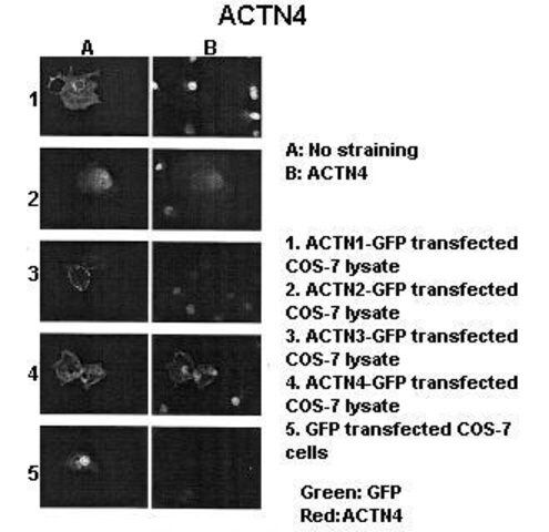 Anti-ACTN4 (AB2) antibody produced in rabbit