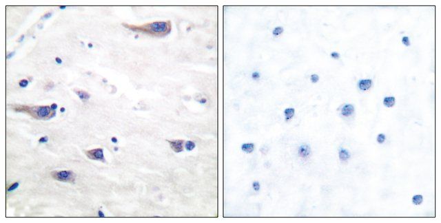 Anti-PDGF Receptor  antibody produced in rabbit