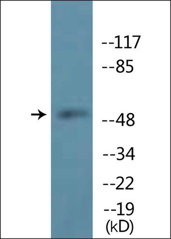 Anti-phospho-TUBA1/3/4 (pTyr<sup>272</sup>) antibody produced in rabbit