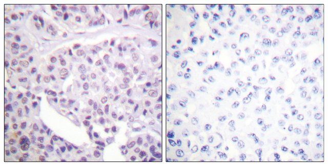 Anti-p53, antibody produced in rabbit