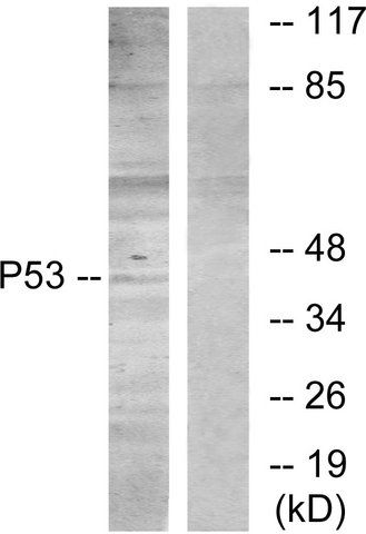 Anti-p53 antibody produced in rabbit