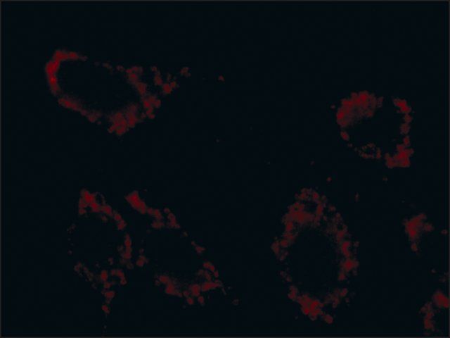 Anti-Superoxide Dismutase (MnSOD) (DD-17)-Cy3 antibody produced in rabbit