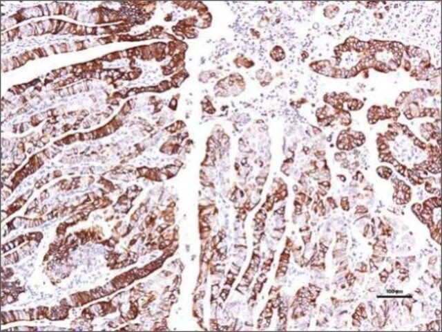 Anti-GPER (C-terminal) antibody produced in rabbit