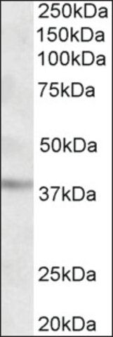 Anti-GHITM antibody produced in goat