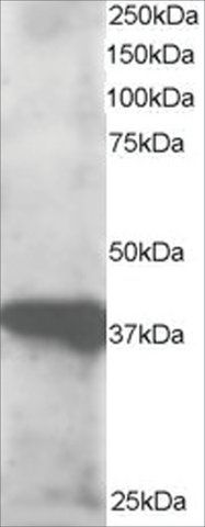 Anti-GIPC3 antibody produced in goat