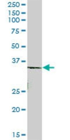 Anti-ROM1 antibody produced in mouse