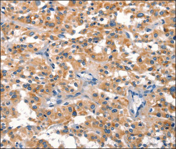 Anti-DUSP2 antibody produced in rabbit