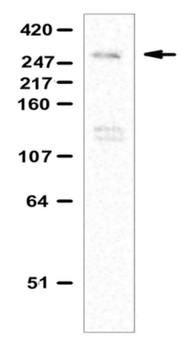 Anti-Ash1L Antibody