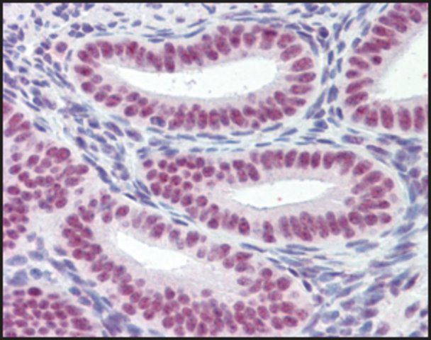 Anti-MORF4L1 (N-terminal) antibody produced in goat