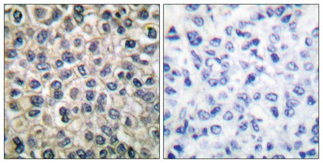 Anti-Catenin- antibody produced in rabbit