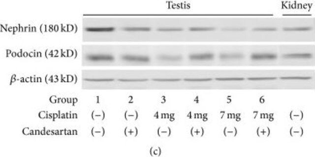 Anti-Podocin antibody produced in rabbit