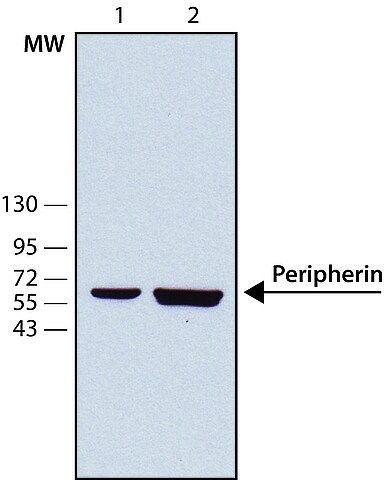 Anti-Peripherin antibody, Mouse monoclonal