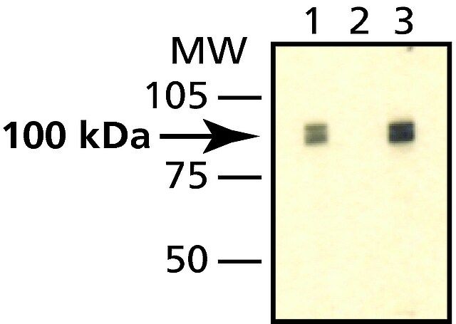 Anti-PM/Scl-100 antibody produced in rabbit