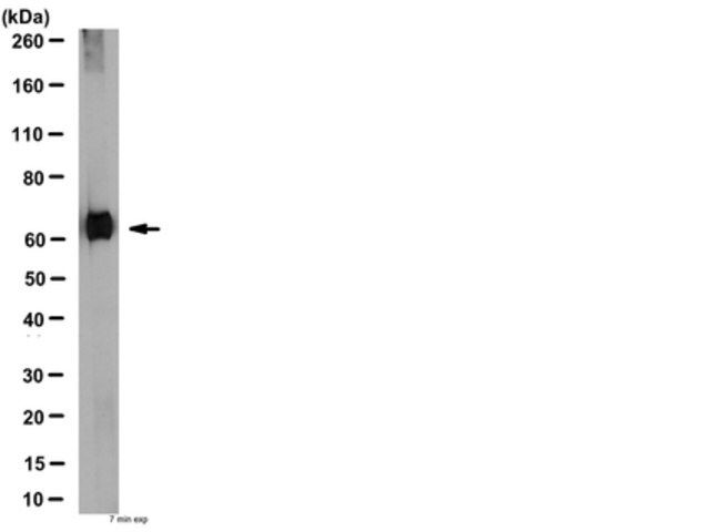 Anti-Serotonin Transporter Antibody