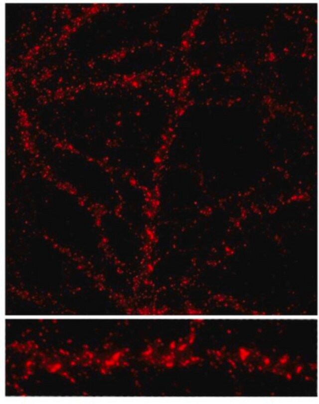 Anti-NMDAR2C Antibody, also recognizes NMDAR2A and 2B