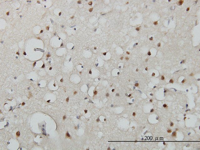 Monoclonal Anti-USF2 antibody produced in mouse