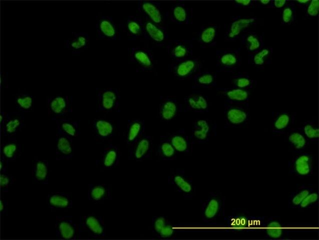 Monoclonal Anti-XPO5 antibody produced in mouse