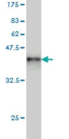 Monoclonal Anti-XPC antibody produced in mouse