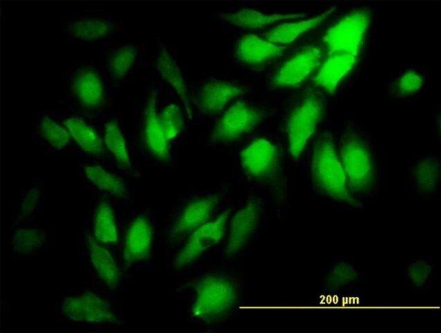 Monoclonal Anti-WDR5 antibody produced in mouse