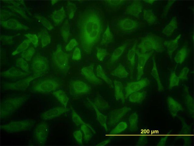 Monoclonal Anti-USP9X antibody produced in mouse