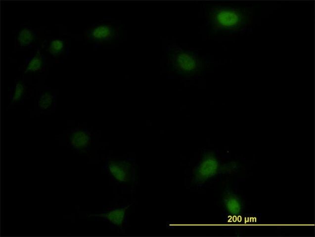 Monoclonal Anti-UBE2M antibody produced in mouse