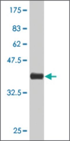 Monoclonal Anti-VMD2 antibody produced in mouse