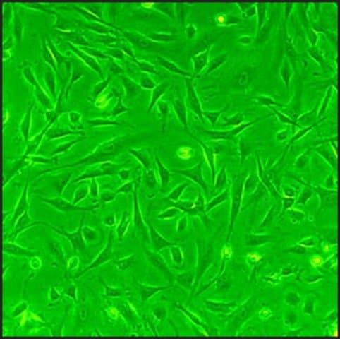 Rat Cardiac Fibroblasts: RCF, neonatal