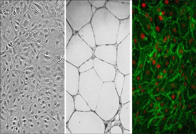 Human Dermal Microvascular Endothelial Cells: CADMEC/HMVEC: Pre-Screened for Angiogenesis &VEGF signaling, neonatal