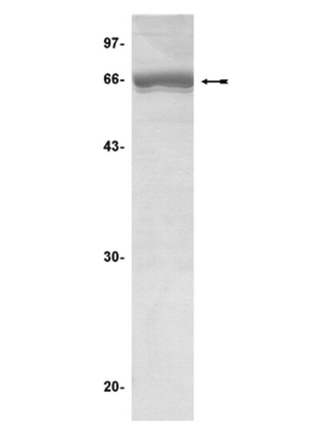 MAPKAP Kinase 2 Protein, inactive, 50 g