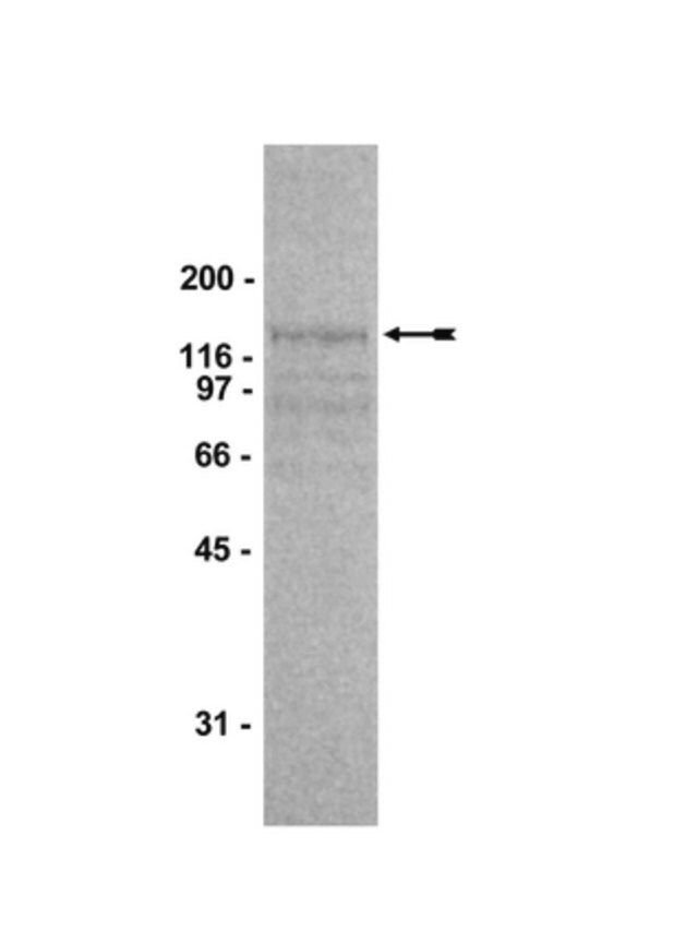 Abl Protein, active, mouse, 10 g