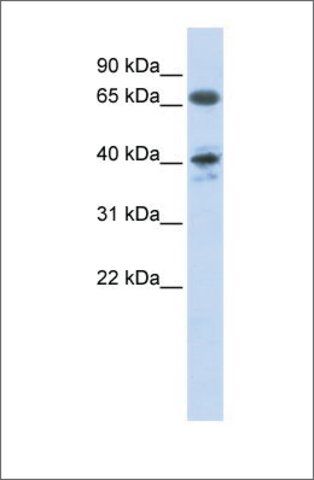 Anti-AGTR1 antibody produced in rabbit