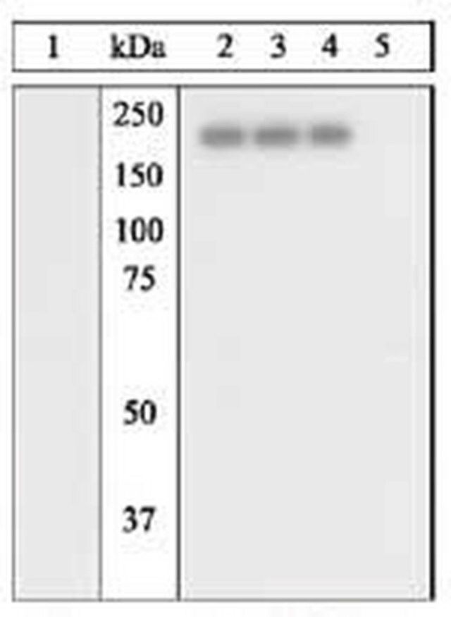 PhosphoDetect Anti-EGFR (pTyr<sup>8</sup><sup>4</sup><sup>5</sup>) Rabbit pAb